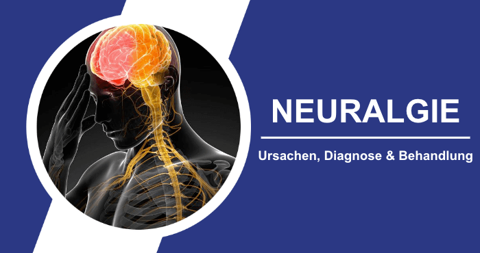 Neuralgie Ursachen Diagnose Behandlung Titelbild
