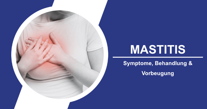 Symptome Behandlung und Vorbeugung von Mastitis Titelbild