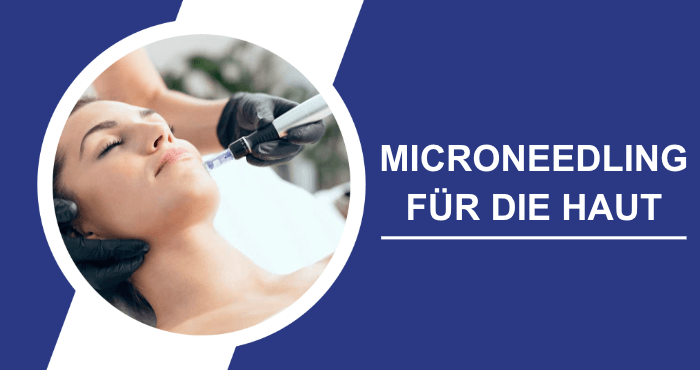 Wie Microneedling der Haut helfen kann Titelbild